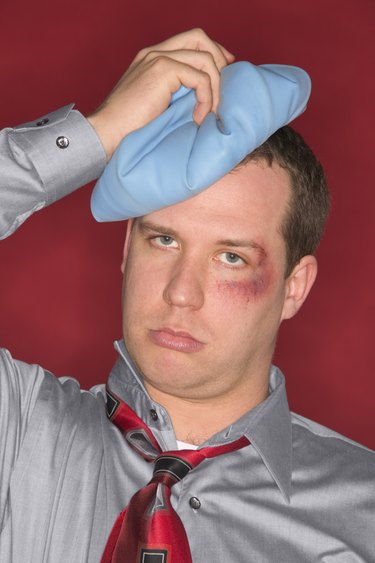 Man with black eye and ice pack